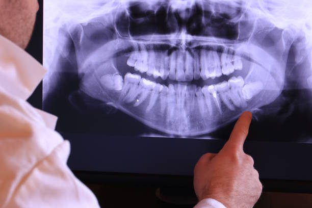 Best Emergency Dental Clinic in ND
